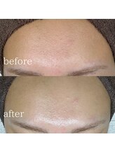 エメリーヌ(AIMELINE)/艶肌WAX +アンストレスマスク