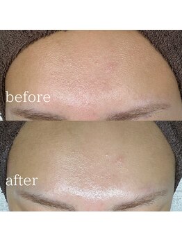 エメリーヌ(AIMELINE)/艶肌WAX +アンストレスマスク