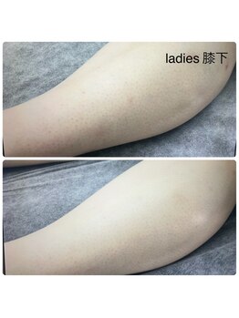 エヌアール(NR)/ladies 膝下