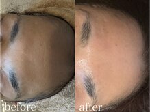 グレイティア(gratia)/韓国ララピール３回目