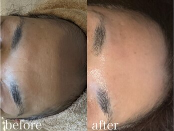 グレイティア(gratia)/韓国ララピール3回目