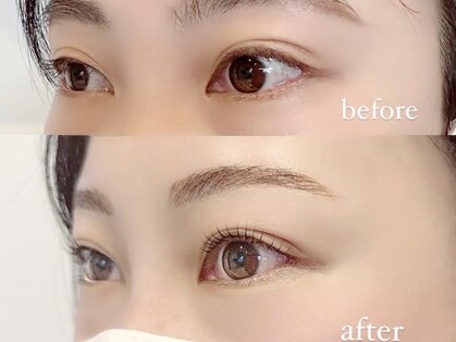 チアリス(chiariss)の写真