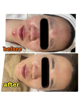 ビズビズ(bisebise)/