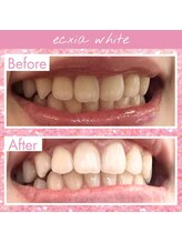 エクシアホワイト 福岡六本松/