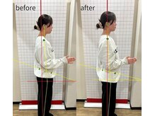 ほねつぎ 高津はりきゅう接骨院の雰囲気(姿勢改善で“根本から”疲れにくい身体に)