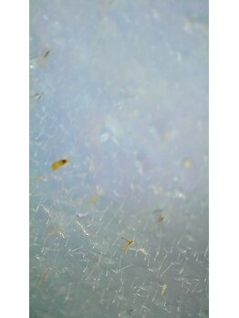 ビューティーサロン ラ ルーチェ(beauty salon La Luce)/顔wax脱毛禁忌事項