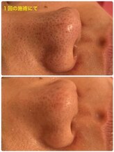 ビビアンローズ(BIBIAN ROSE)/一度スッキリと