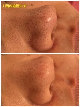 ビビアンローズ(BIBIAN ROSE)/一度スッキリと