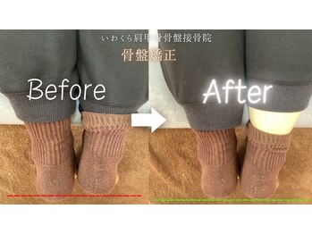 いわくら肩甲骨 骨盤接骨院BTG 一宮千秋/骨盤矯正・足関節矯正 1