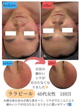 ユフラ(Juhla)/ララピール