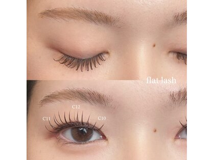 トレス(tress)の写真