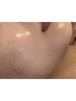 お肌をきれいにしたい