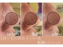 たかや鍼灸 整体院