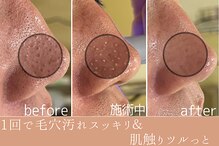 たかや鍼灸 整体院