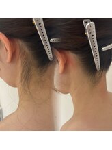 ラヴィン なんばスカイオ店(Lovin)/花嫁♪襟足＆背中　産毛ケア