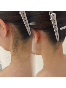 ラヴィン なんばスカイオ店(Lovin)/花嫁♪襟足＆背中　産毛ケア