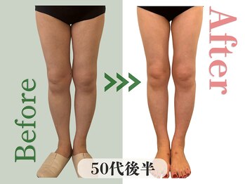 アムール(Amour)/太ももに隙間ができた★50代