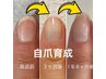 自爪育成アフターフォローコース(単発前回ケアから3ヶ月以内)☆彡