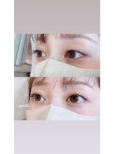 ルラン(luran)/ビフォーアフター！