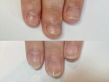 キラネイル アンド アイラッシュ by World Beauty(KIRA)/自爪育成