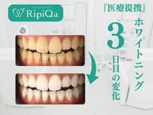 リピカ(RipiQa)/施術例