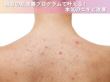 ロエヴェ(ROEWE)の雰囲気（背中ニキビ・毛穴ケアは素肌専門店で。ブライダルでも大人気♪）