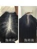 【4-50代以上向け★髪のハリコシUP】鍼灸で育毛促進コース60分¥18150