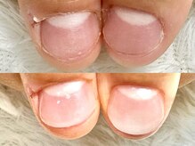 グレースレディ/地爪『質』と『土台』を変えます