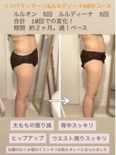 ヨサパーク ハナ(YOSA PARK hana)/