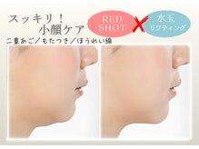ジヒカ(ZIHICA)/ 【最新☆RED SHOT】輪郭形成