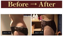 グレースフルタイム プレミアム(Graceful Time PREMIUM)/ビフォーアフター