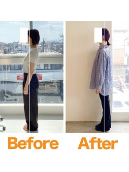 整体院ひなた 都城院/猫背と反り腰改善!!