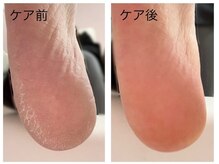 エヌクチュール(N.couture)の雰囲気（人気のフットケア♪足爪のみのケアメニューもございます◎）