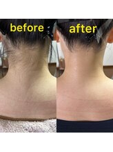 ホヌ(HONU)/ボディーシェービング