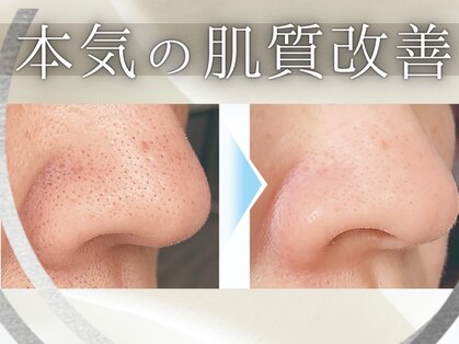 ビアル(VIALU)の写真