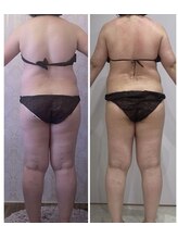 ルポーゼ(Repose)/