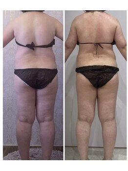 ルポーゼ(Repose)/