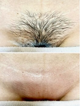 サロン ド ワイシス(Salon de ysis)の写真/【オーガニック材料のシュガーリング脱毛×光の機械脱毛】ムダ毛のない自信のツルスベ肌へ導きます☆