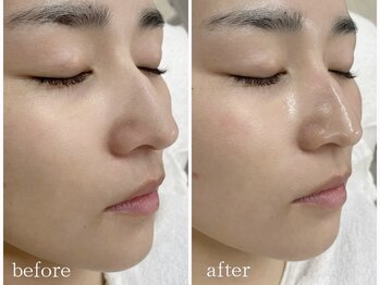 ラソ 束本店(lazo)の写真/【憧れの素肌へ★】即効トーンアップwax、水光肌ララピール、根本ケアのクリスティーナ！魅せる素肌へ★