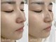 ラソ 束本店(lazo)の写真/【憧れの素肌へ★】即効トーンアップwax、水光肌ララピール、根本ケアのクリスティーナ！魅せる素肌へ★