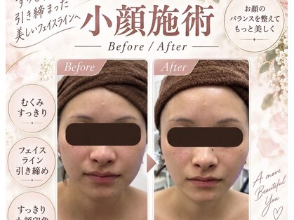 ステラ(Stella)の写真