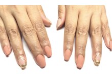 ネイルアトリエサリ(Nail Atelier Sari)/デザインSコース　￥6980