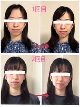 プレシャス(precious)/小顔ヘッドビフォーアフター