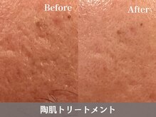 トウメイコガオ 横浜店/トウメイコガオでハーブ