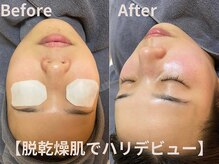 グレース 吉祥寺(grace)/一度で【変化】を実感できます