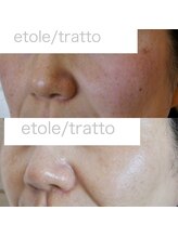 ザ シー タイムレスビューティ(THE SHE)/50代お客様症例写真