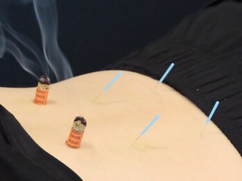 自分メンテの写真/【国家資格所持者による本格施術が高評価◎】自立神経の乱れを整え日々のストレスや疲労感をスッキリ解消♪