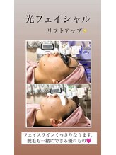 顔凛(カオリン)/フェイスラインもスッキリ