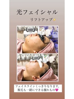 顔凛(カオリン)/フェイスラインもスッキリ