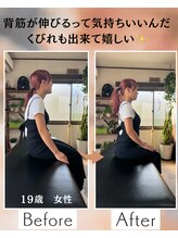 ウェルビーイング整体院 水戸赤塚店(wellbeing整体院)/Before After